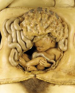 Anatomisch model van een ovariumzwangerschap (detail) (was)