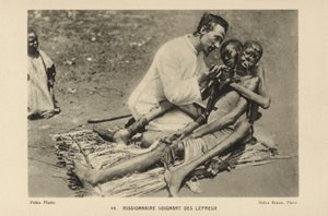 Missionaris die lepralijders verzorgt door French Photographer