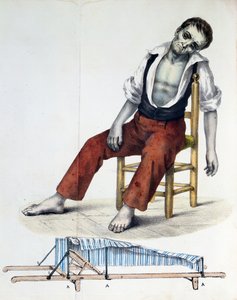 Cholera Morbus, uit Relacao, Historica, Statistica e Medica da Cholera-Morbus door Francisco d