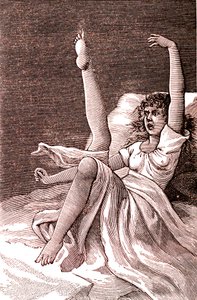 Hysterie, een extreem mentaal fenomeen, psychosen en psychoneurosen.1887