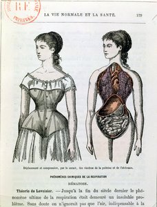 De schadelijke effecten van het korset, illustratie uit La Vie Normale et la Sante door Dr. Jules Rengade (geb. 1841) ca. 1880 door French School