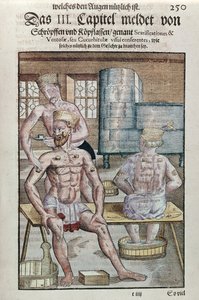 Cupping, uit Ophthalmodouleia door Georg Bartisch (1535-1636) gepubliceerd in Dresden in 1583