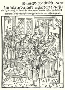 Dokters aan het bed van een man met een gebroken been (gravure) door German School