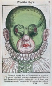 Masker voor de behandeling van strabismus, uit Ophthalmodouleia door Georg Bartisch, gepubliceerd in Dresden in 1583 door German School