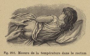 Temperatuur van een kind nemen via het rectum door German School
