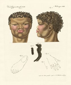 De hottentot of bosjesman