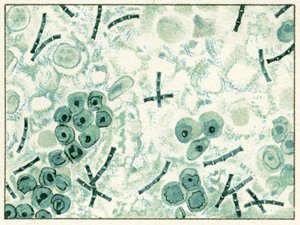 Monster van miltvuurbacteriën in bloed