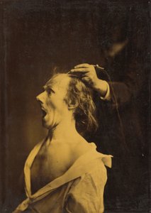 Verbazing, Verbijstering, Verwondering