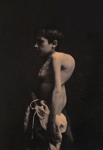 Portret van een gebochelde jongen