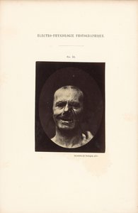 Fotografische elektrofysiologie, Afbeelding 53 door Guillaume Benjamin Duchenne