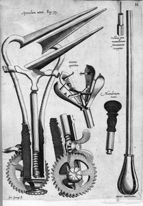 Gynaecologie: Plaat met een speculum. Gravure door Girolamo Fabricii in 