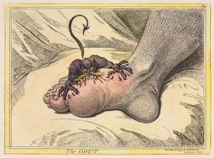 De Jicht door James Gillray