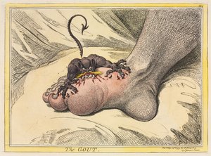 De jicht door James Gillray