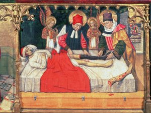 SS. Cosmas en Damian transplanteren het been van een Ethiopische man op de stomp van diaken Justinianus door Jaume Huguet