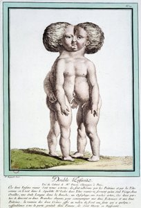 Siamese kinderen - in "Les déviations de la nature" door Régnault door Jean Baptiste Regnault