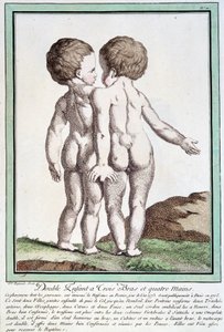 Siamese kinderen - in 