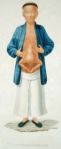 Chinese man met een onontwikkelde siamese tweeling aan zijn buik, illustratie uit een Frans reisboek, gegraveerd door M. Legrand