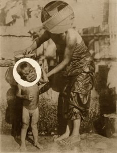 Moedervlek (Salome)