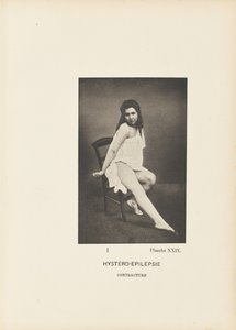 Hystero-epilepsie contractuur