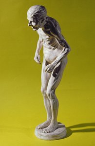 Beeld van een vrouw met de ziekte van Parkinson