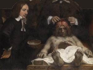 De anatomische les van Dr. Jan Deyman, 1656 door Rembrandt van Rijn