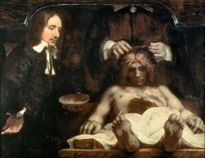 De anatomie van Dr. Johan Deijman door Rembrandt van Rijn