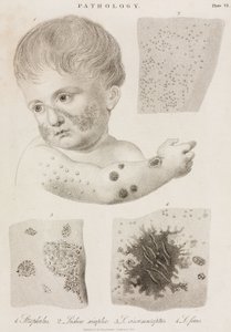 Dermatologie Soorten huidziekten door John Pardon