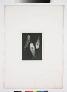Diagnostische radiologie, röntgenfoto