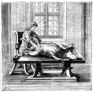 Dier-tot-mens bloedtransfusie, 1679 door Unbekannt