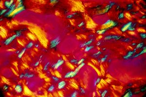 Bio-materialen, LM Bot