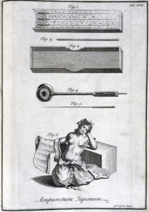 Alternatieve geneeskunde: plaat met acupunctuurnaalden en hun toepassing, gravure uit 