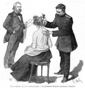 Professor Bergmann injecteert een tuberculosepatiënt, 1891