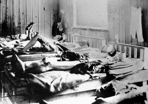 Overlevenden van de explosie van de atoombom in Hiroshima, Japan, 1945