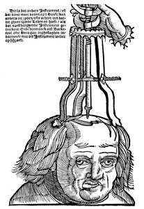Trepanatie, 1593