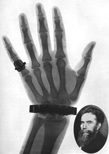 Röntgenfoto van een hand, 1926 door Unbekannt