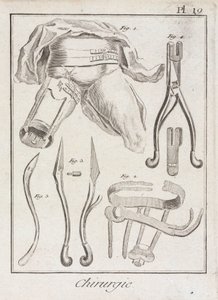 Vroege moderne orthopedische chirurgie