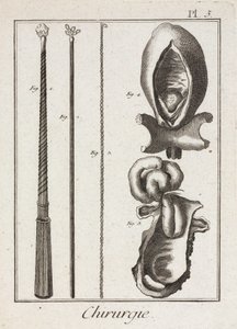 Uitrusting, vroegmoderne chirurgische instrumenten en diagrammen van lichaamsdelen door Unbekannt