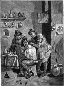 Een kwakzalverchirurg in de 18e eeuw onderzoekt een schouderblessure. (Van een gravure uit die tijd). Gravure in 