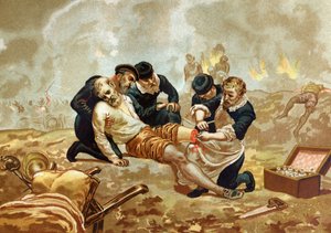 Ambroise Pare Arts en Franse chirurg (ca. 1509-1590) beoefent ligatie van slagaders na amputatie. van na hombres y Mujeres celebres. Barcelona 1877.