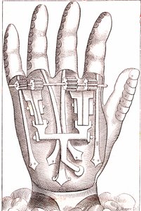 Kunstmatige handprothese door de Franse chirurg-anatoom Ambroise Paré