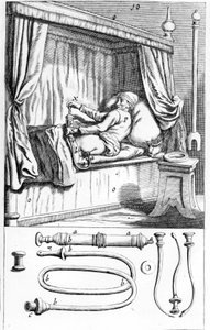 Clystère (voor klysma