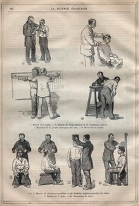 De gerechtelijke antropometrie of bertillonnage, methode van Alphonse Bertillon (1853-1914) - Gravure in 
