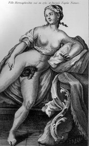Hermafrodiete meisje gezien in 1751 en getekend naar de natuur door Unknown artist