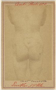 [Jno. E. Tucker, in de billen geschoten, slachtoffer burgeroorlog]. door Unknown artist