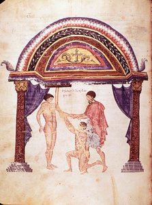 Geneeskunde: reductie van een ontwrichte elleboog, patiënt wordt opgehangen aan de arm (manuscript)