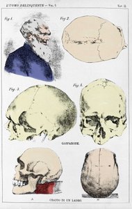 Studie over de morfologie van een misdadigersschedel door de Italiaanse criminoloog door Unknown artist