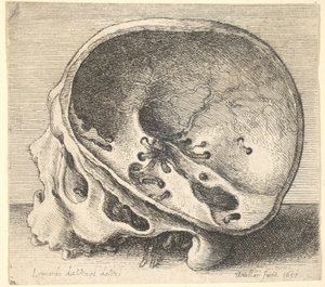 Gesneden schedel in profiel naar links met de linkerzijde van de schedel verwijderd, 1651 door Wenceslaus Hollar
