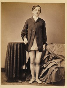 Soldaat G. W. Warrington, Herstel zonder amputatie na een schotbreuk in de rechterpatella, uit de fotocatalogus van de chirurgische afdeling