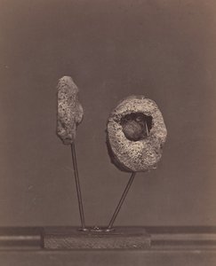 Uitgesneden kniegewricht. Een ronde musketbal in de binnenste condyl van het rechterdijbeen [Gardin..., 1866-67