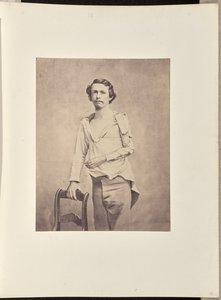 Succesvolle excisie van de kop van de linker humerus, gevolgd door necrose en secundaire excisie van de rest van de humerus en de bovenste extremiteiten van de radius en ulna door William H. Bell